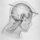 Illustration for article titled Reason for Conspiracy? 5 Mysterious Details From JFKs Autopsy